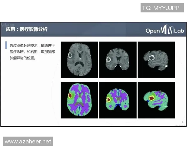杭州排球队的包夹战术解析与实战应用探讨 杭州排球队的包夹战术解析与实战应用探讨